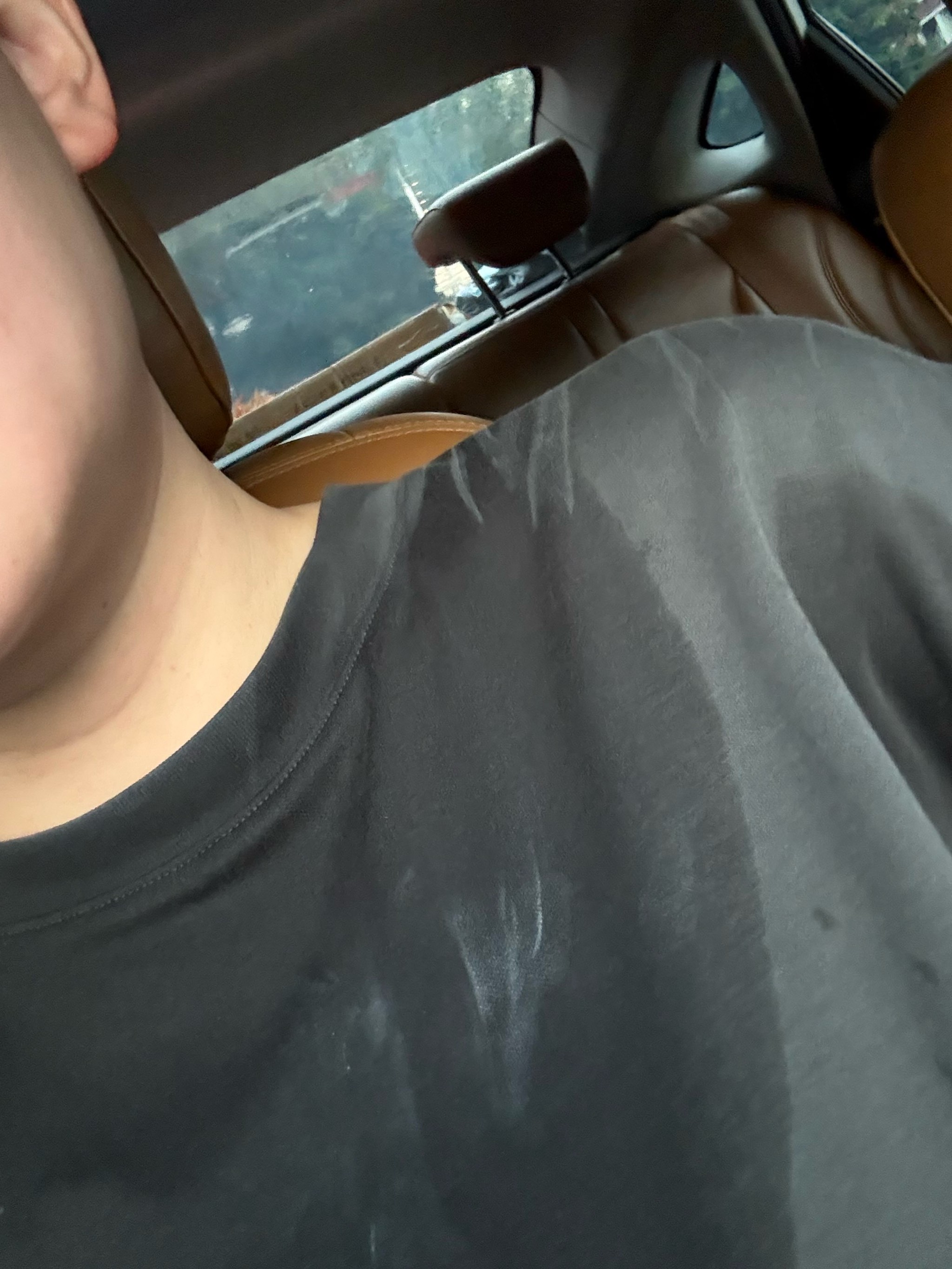 球队的攻击 球队的攻击